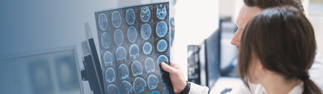different types of seizures